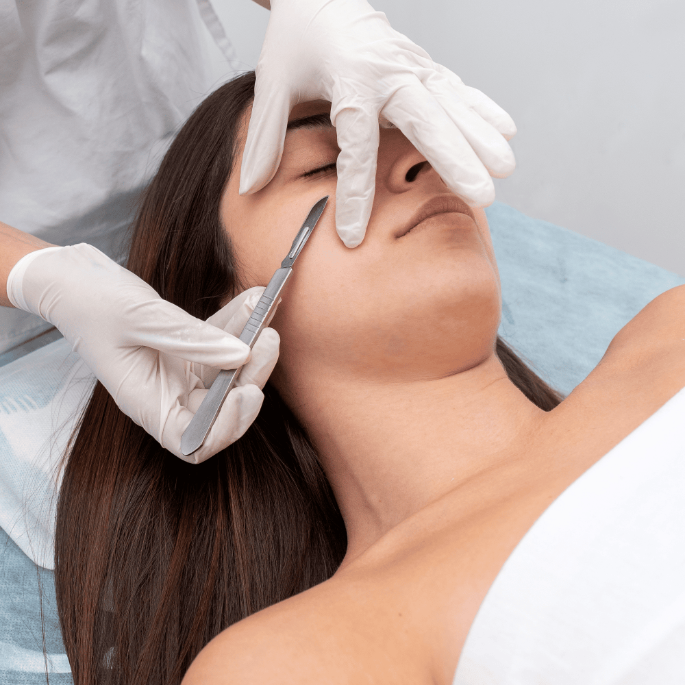 Tratamiento Dermaplaning