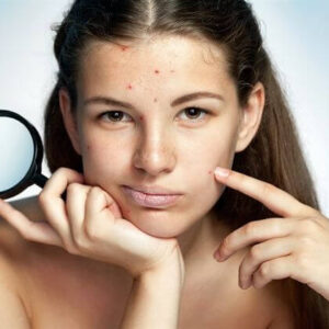 Limpieza Facial Para adolecentes